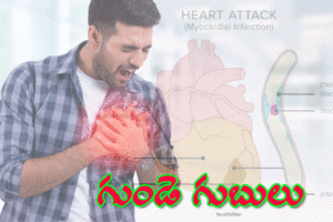 Heart Attacks Health Emergency